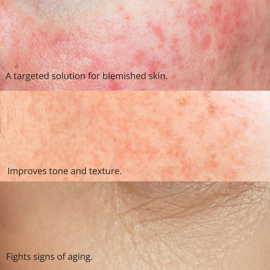 Brightening Glow